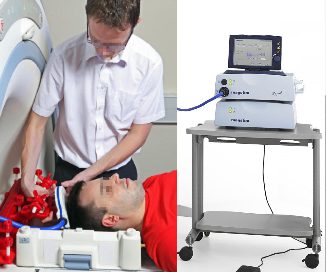 核磁下同步磁刺激线圈